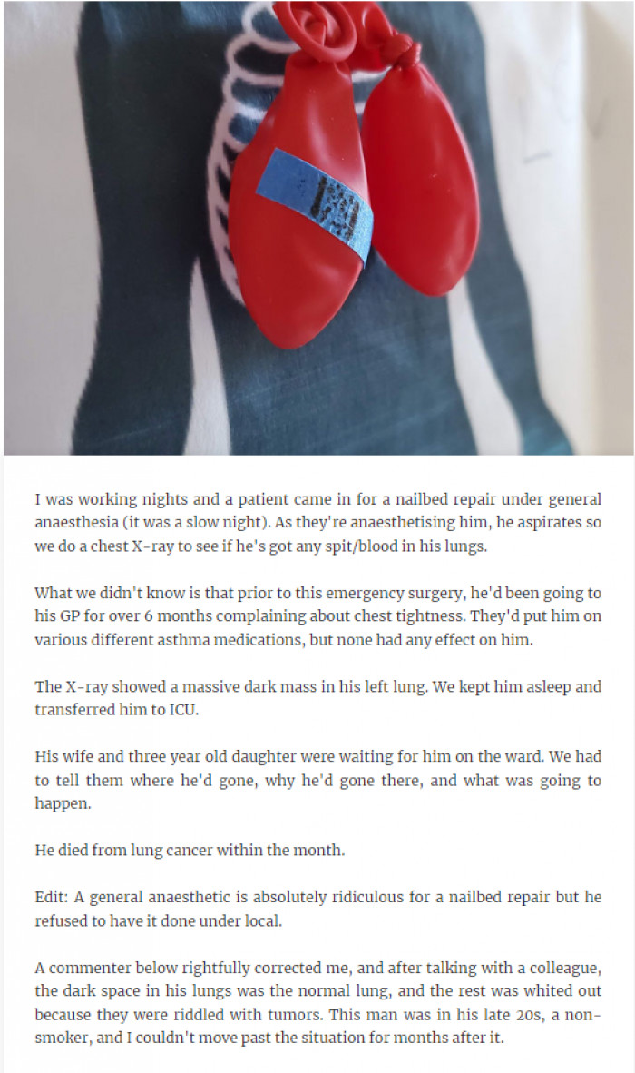 21. He died within a month.