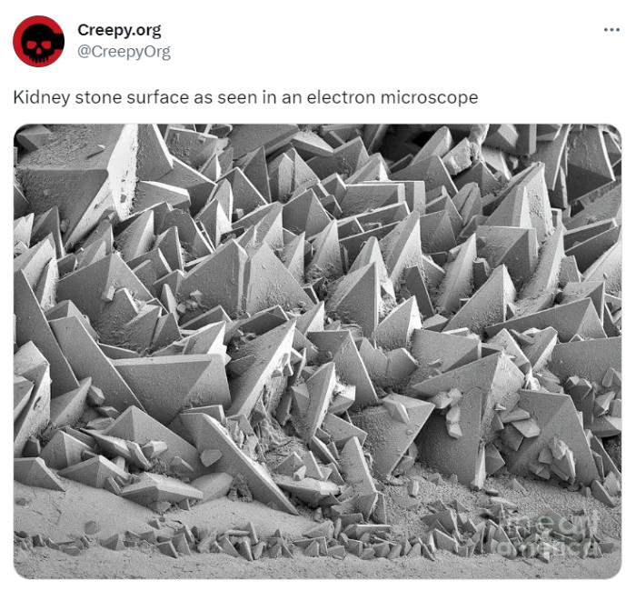 15. No wonder they hurt so bad