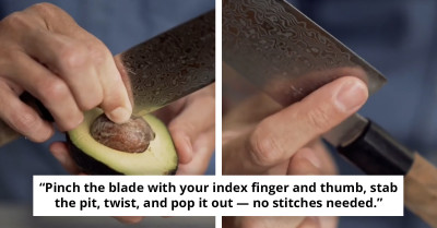 Apparently, “Avocado Hand” Is A Thing — And This Doctor Just Saved Thousands Of Brunch Lovers From The ER