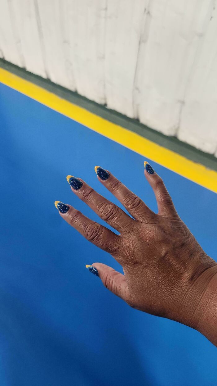 "Felt Cute Until I Realized I Looked Like The Painted Safety Lines At Work"