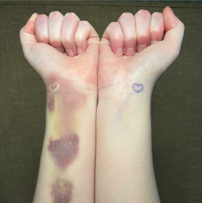 42. My Invisible (White) Tattoo Is Currently Visible