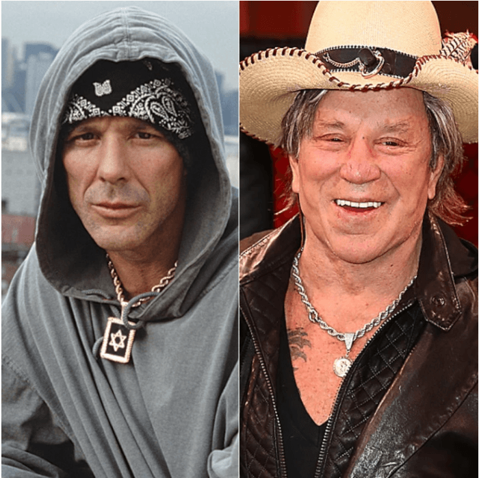 16. Mickey Rourke thought it would be amusing to release a photo from his most recent cosmetic surgery, a nose operation, in 2017 after undergoing various surgeries.