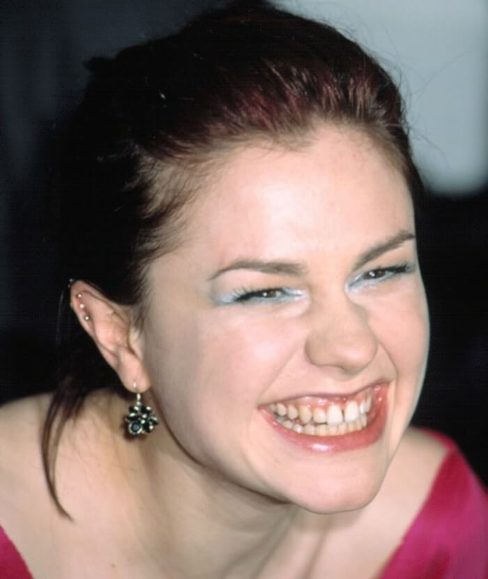 11. While many actors get their dental issues fixed, Anna Paquin doesn't seem motivated to have anything done. As she ages, her tooth gap widens.