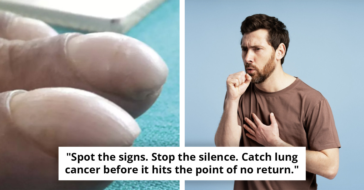 Early Detection: Subtle Nail Changes Could Indicate Serious Illness Before Symptoms Emerge