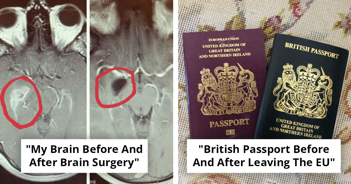 90 Before-And-After Photos So Interesting They'll Mess With Your Sense of Time