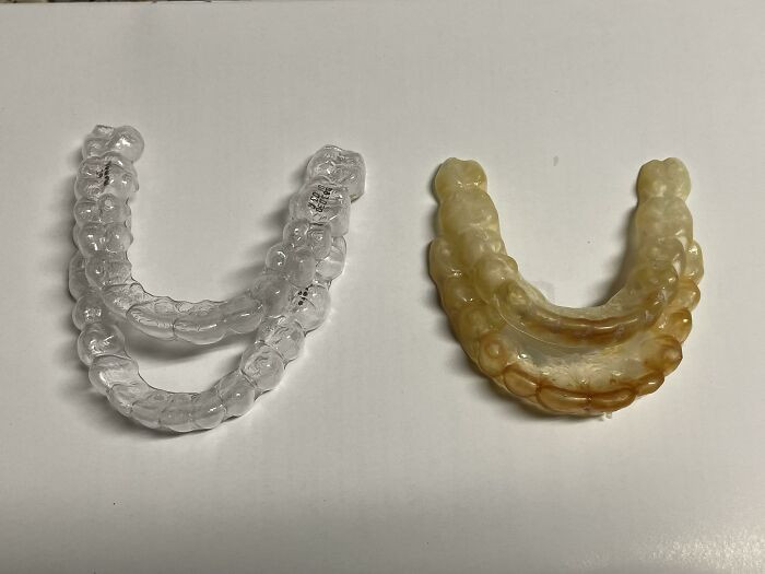 "New Retainer vs. Old Retainer"