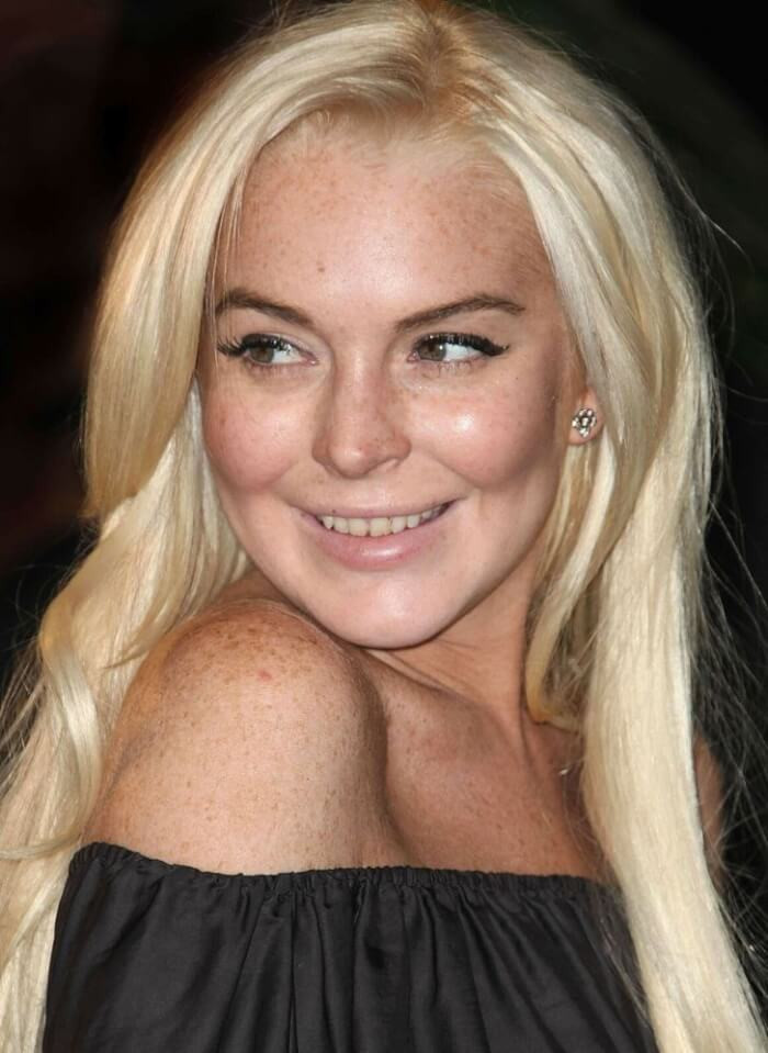 3. Lindsay Lohan's teeth were damaged by her years of partying.