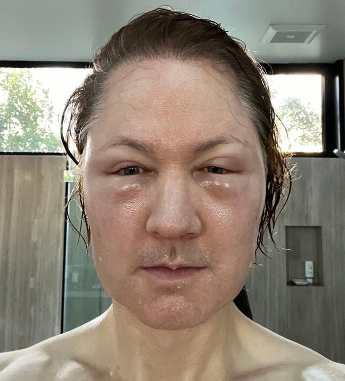 Bryan Johnson faces the unexpected side of biohacking