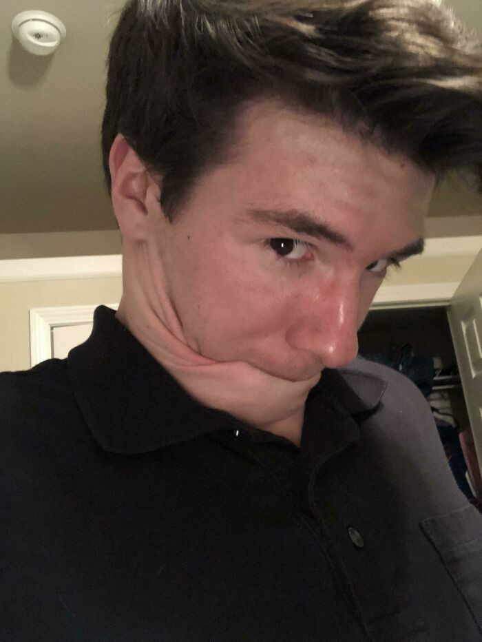 "My Neck Skin Is Stretchy Enough To Allow Me To Suck On It With No Hands"