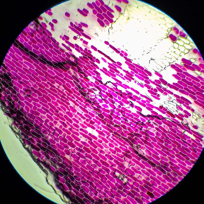 "Plasmolized Red Onion Cells Under Microscope"