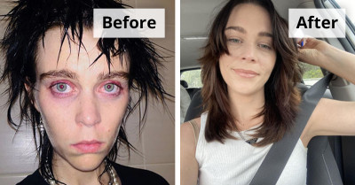 50 Powerful Before And After Photos Of People Beating Addiction