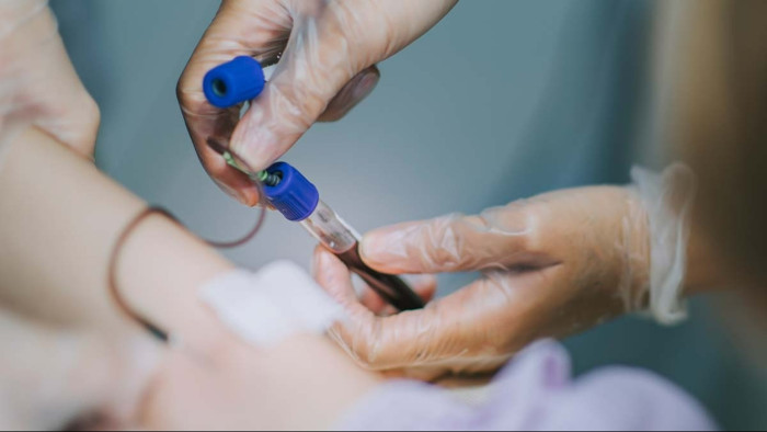 Chart linking Type A blood to higher LDL cholesterol risk