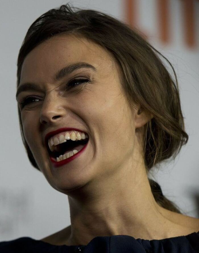1. Keira Knightley won't ever have her uneven bite fixed because she believes every smile is unique.