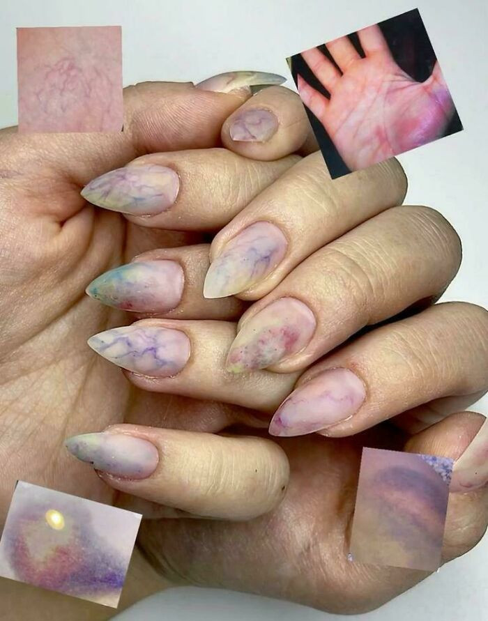 "Bruised And Veiny Nail Art"