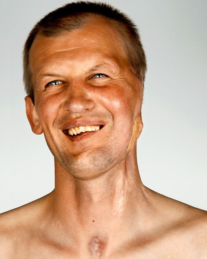 Daniel Sweig portrait with scars, Tessa humankind theme, Oleksandr shown.