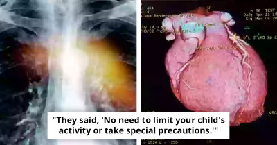 Thousands Could Have A 'Hole In The Heart' Without Knowing — Here Are The Symptoms To Watch For