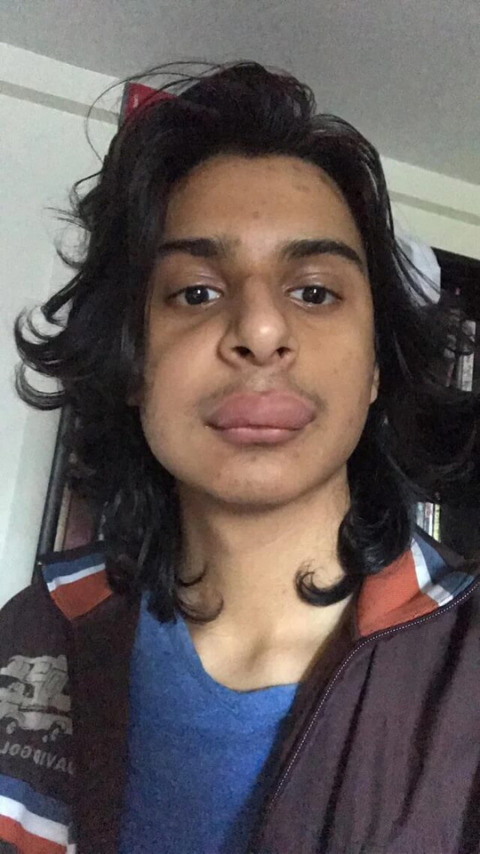 10. I just got stung by a wasp, and I have a job interview later today… I can’t even talk right.