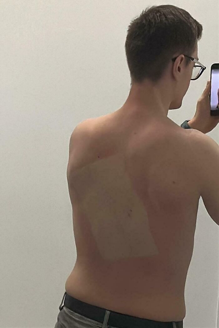 "Thought I'd Try A Tanning Booth For The First Time. Did Not Notice The Cardboard That I Laid On"