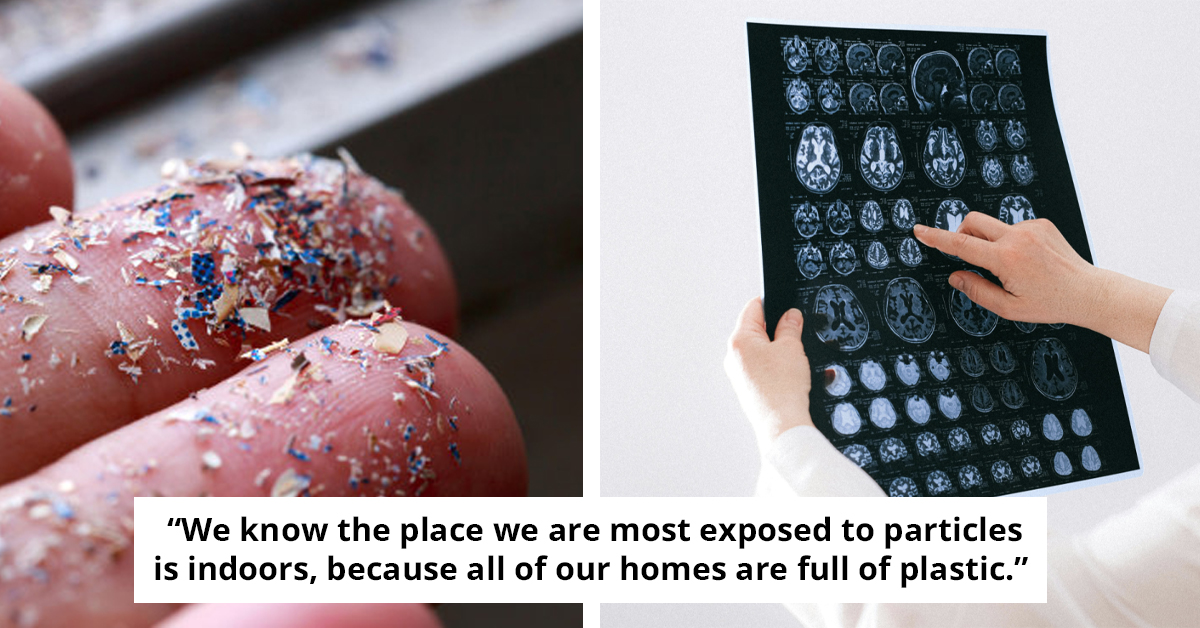 Study Shows That Microplastics Can Actually Get Into Your Brain Tissue