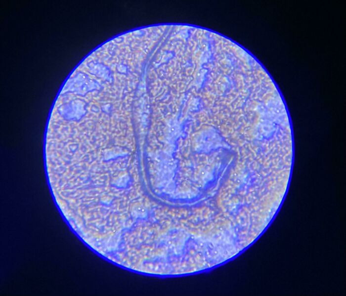 "Was Playing Around With My Son’s New Microscope. Decided To Look At A Drop Of My Blood"