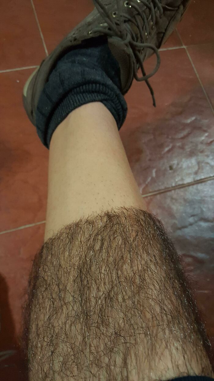 "My Hairy Leg After And Before Shaving!"