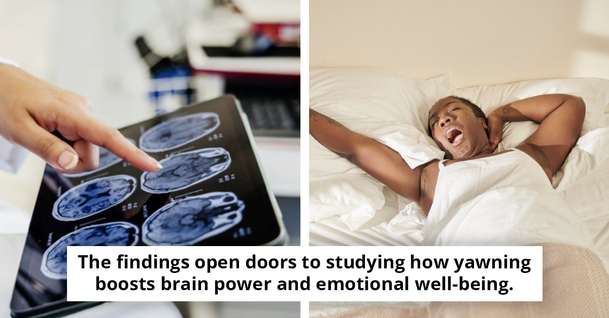MRI Scans Uncover Unexpected Effects of Yawning on Our Brains
