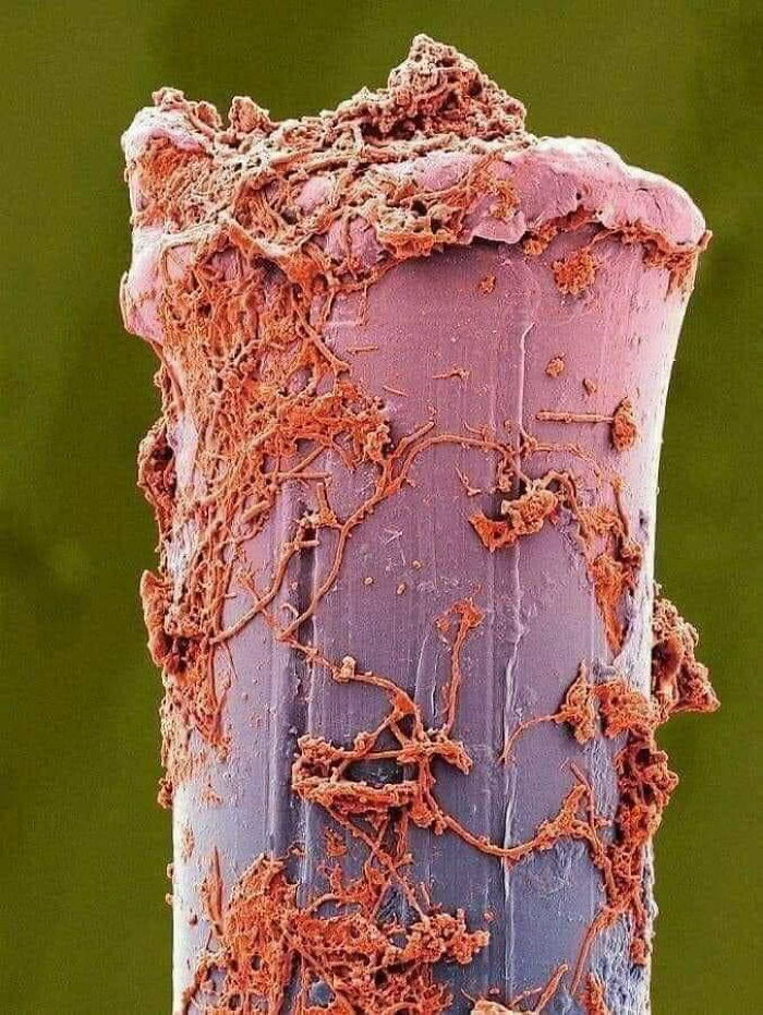 "A Used Toothbrush Bristle Under An Electron Microscope"