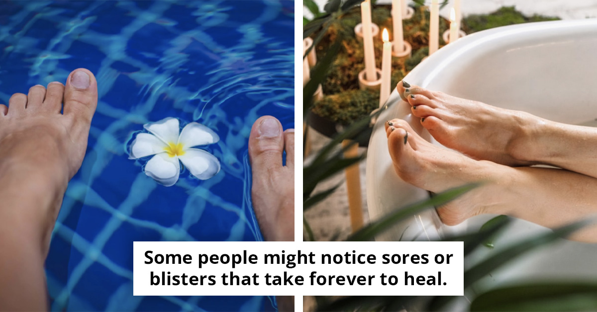 Your Feet Might Be Warning You About Heart Trouble