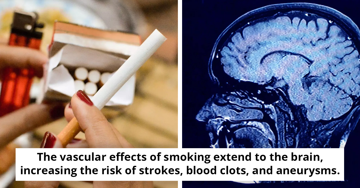 How Smoking Impacts Your Entire Body - A Detailed Look