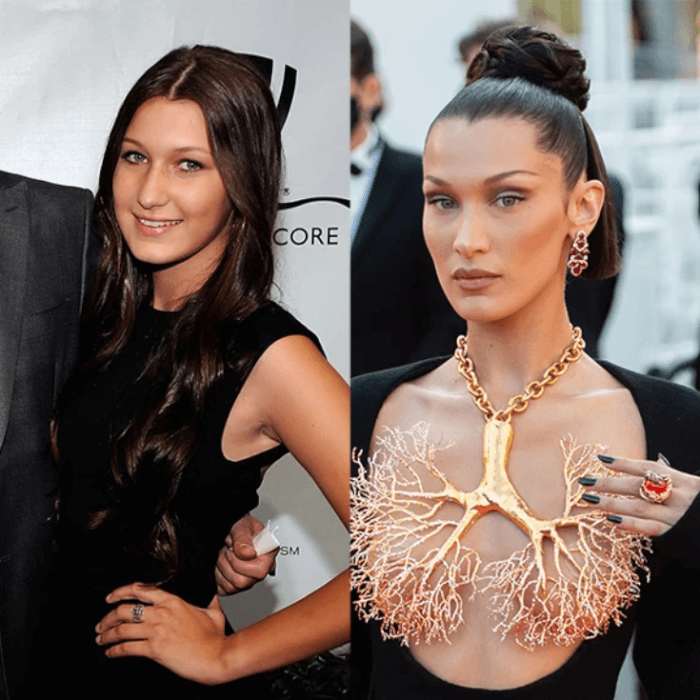 19. Bella Hadid has acknowledged that she regrets having a nose operation at the young age of 14. She wishes she had kept her ancestors’ noses.