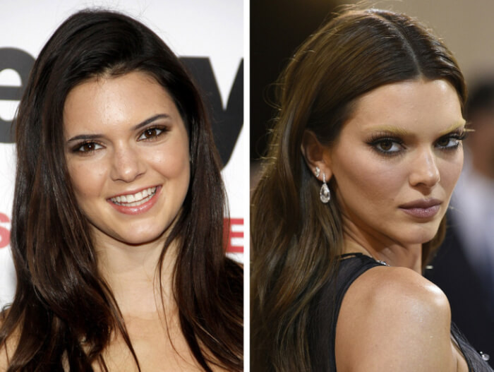 1. Kendall Jenner