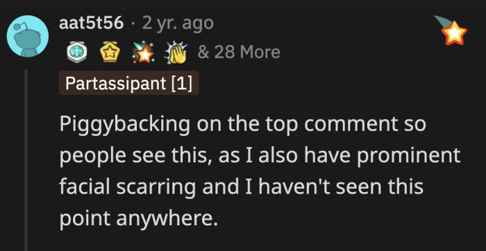 OP's family are doing more than just making fun of her scar