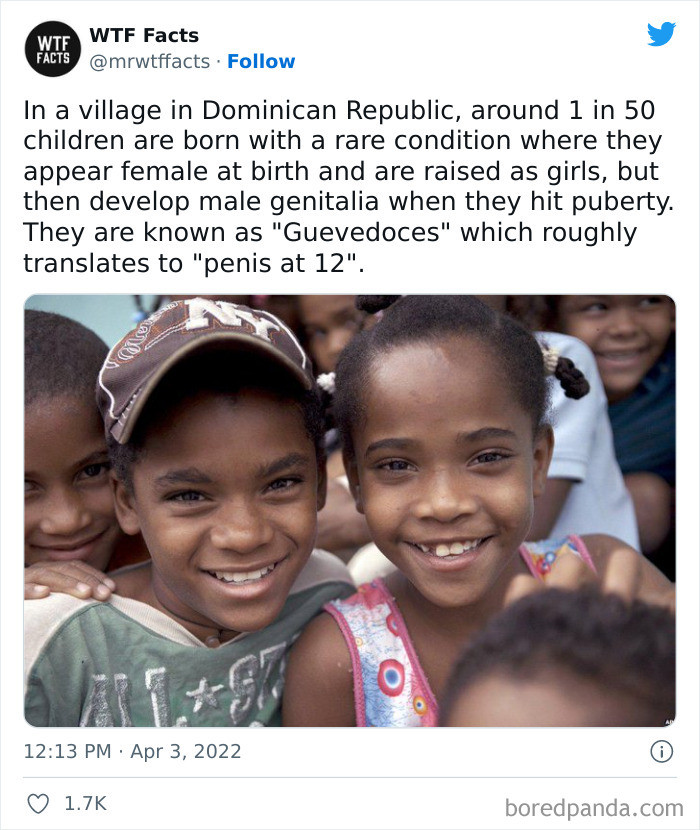40. In a village in the Dominican Republic, children are born with a rare condition