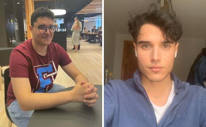 "19-22 (Double Jaw Surgery)"