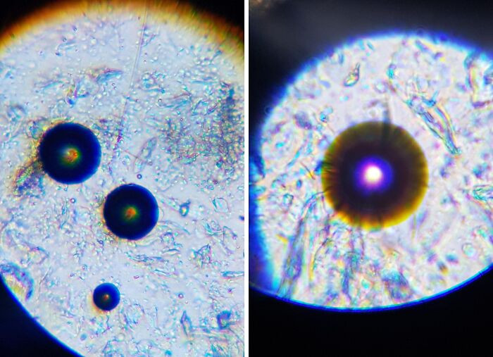 "Got A New Microscope And Had A Look At My Partner's Saliva"