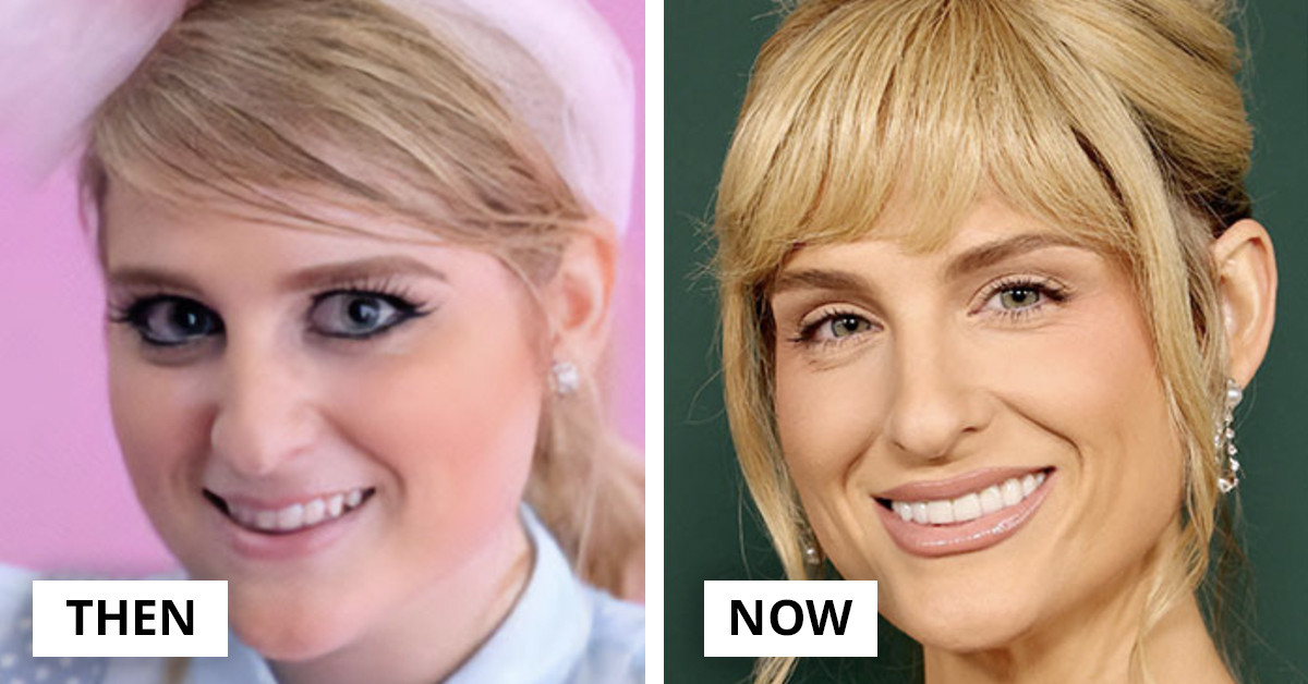 A-List Transformations Everyone’s Talking About