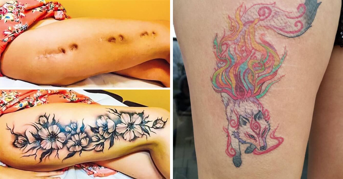 23 Instances Where Tattoos Transform Birthmarks And Scars Into Striking And Impressive Artworks