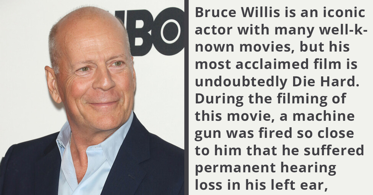 15 Actors Who Suffered Lasting Physical Changes From A Difficult Role