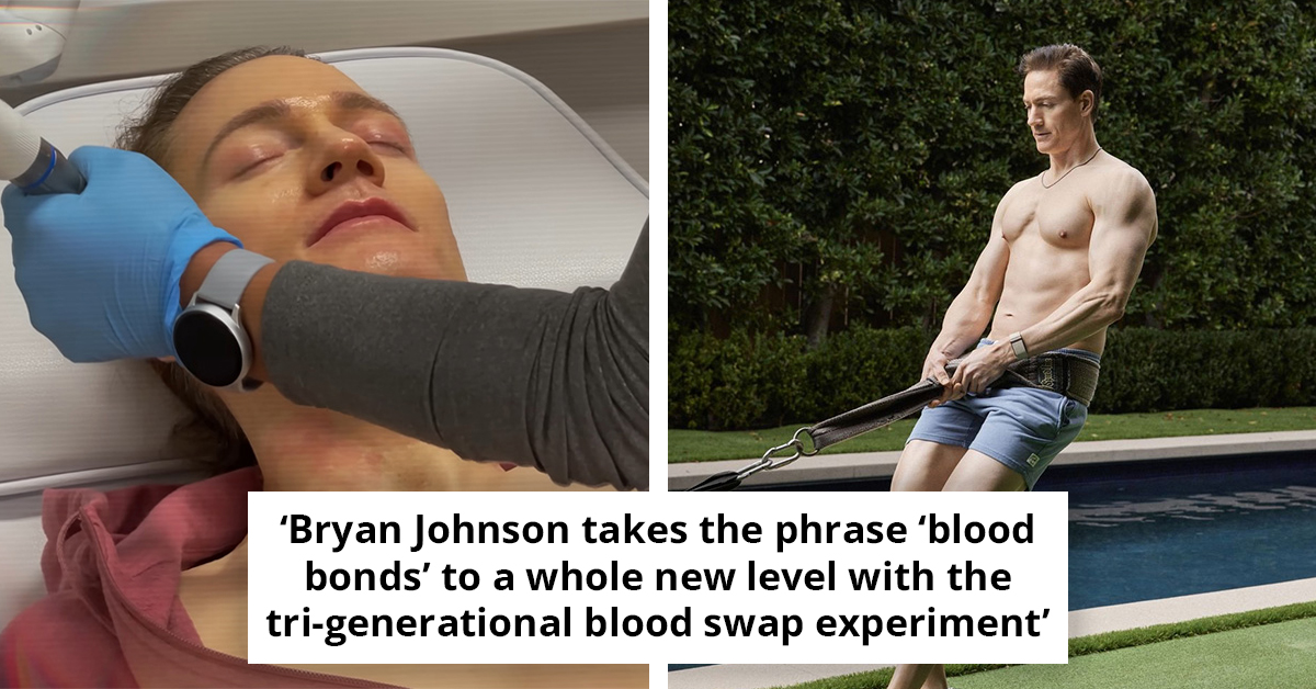 Tech Tycoon’s Anti-Aging Experiments Aimed At Making Death ‘Optional’ Takes Shocking Turn With Botched Facial Injections