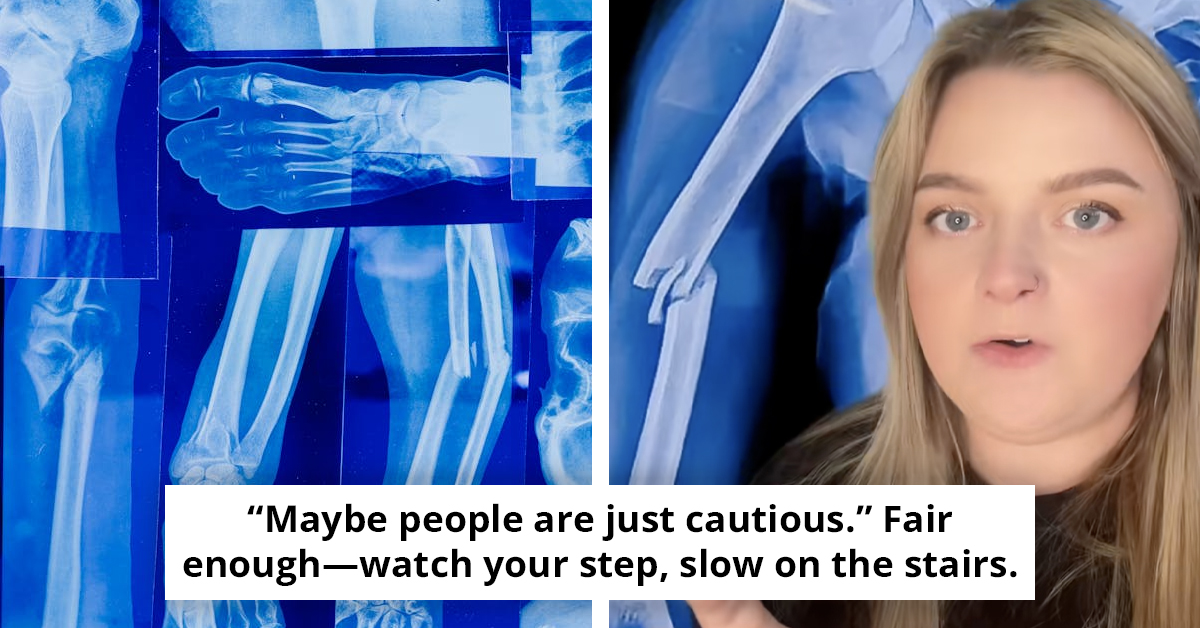 Unpacking The 'Never Broken A Bone' Theory That's Captivating TikTok