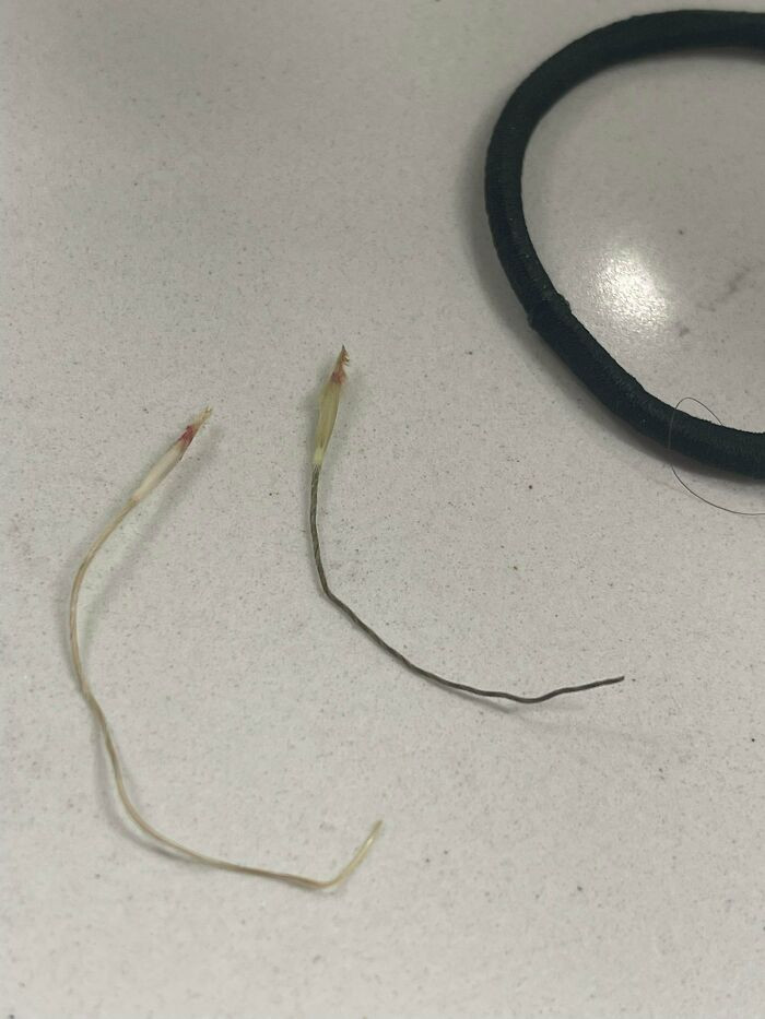 12. Pulled These Out Of My Dogs Armpit, What Is This?