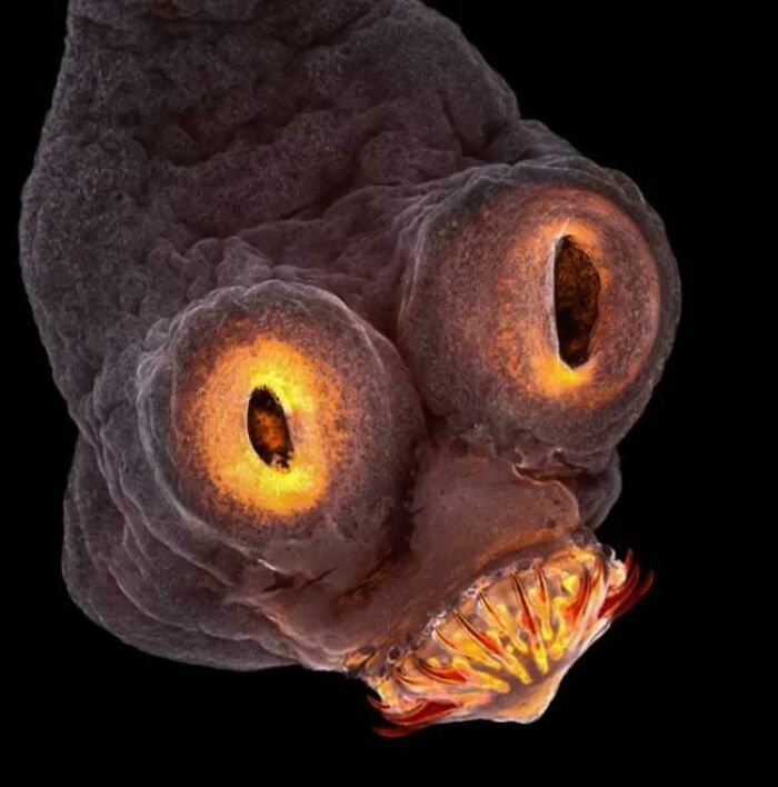 40. Microscopic Image Of A Tapeworm's Head