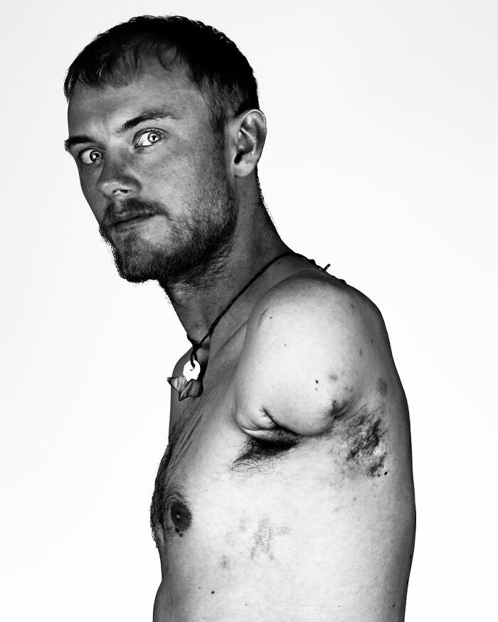 Valentyna portrait showing scars, Axel Schylström and Brock Elbank’s work highlighted.