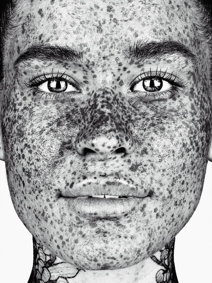 “Polly” - Freckles