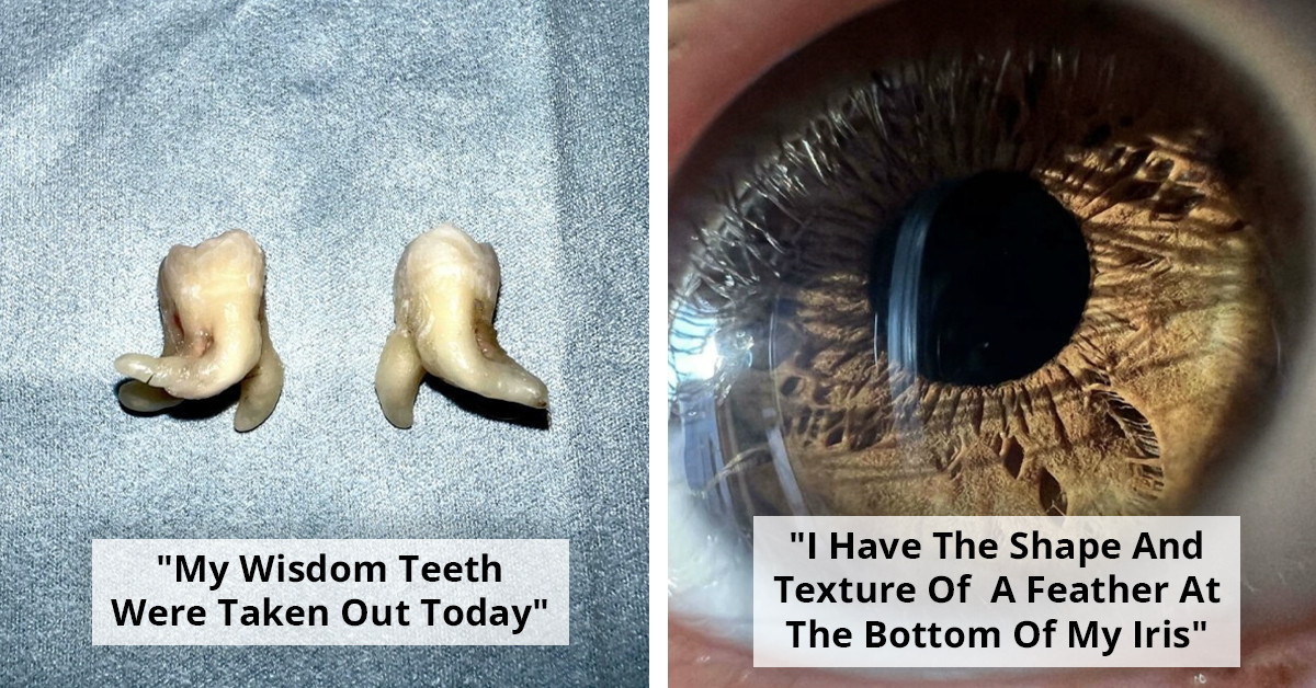 80 People Showing Off the Features That Make Them One of a Kind