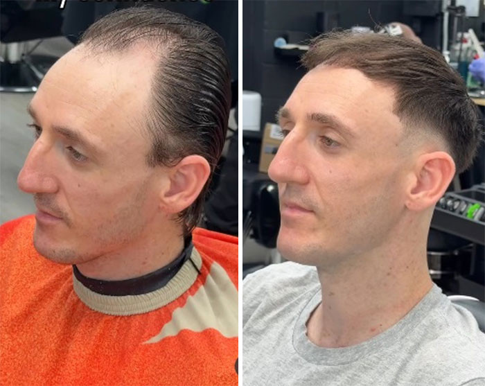 Before & After