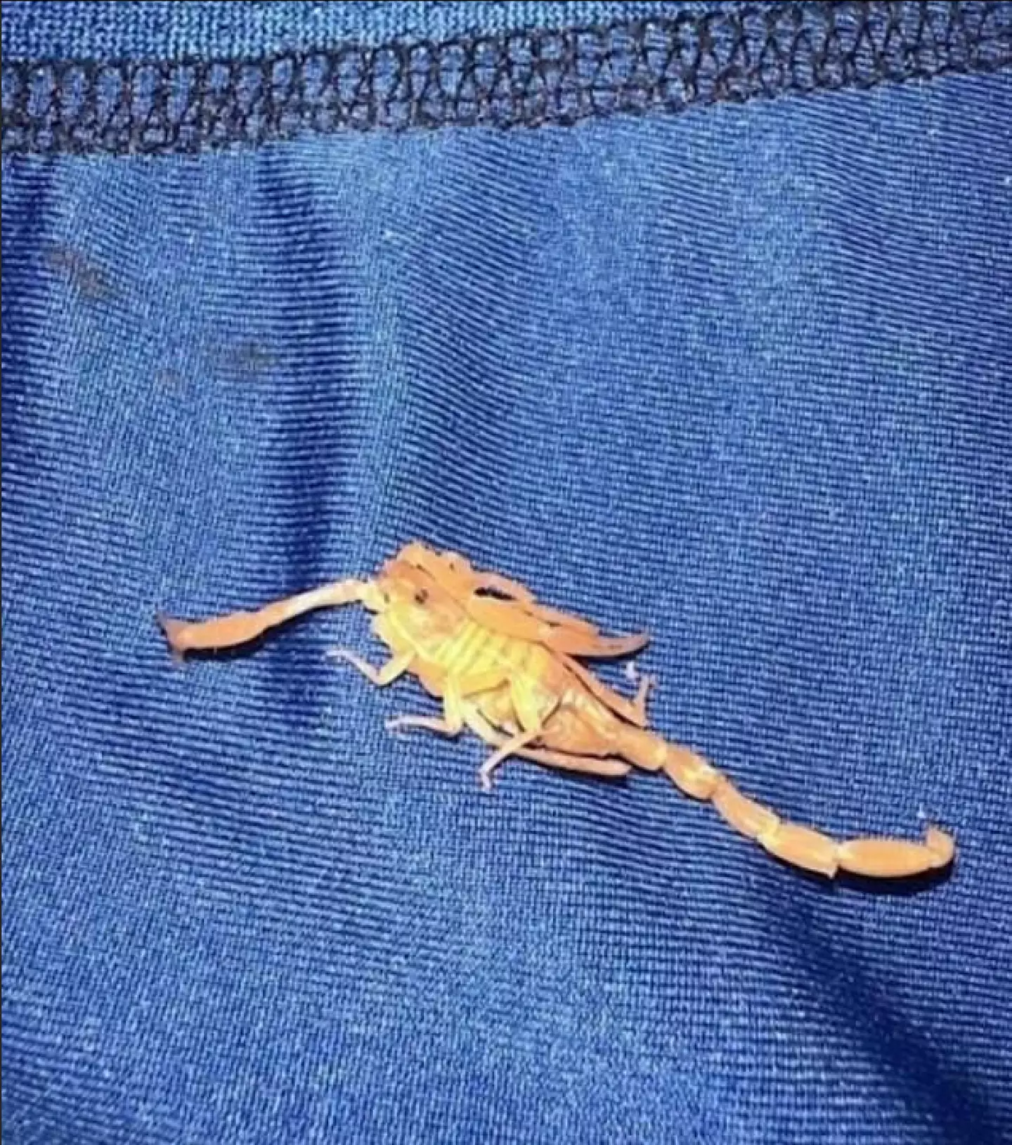 Michael asserts that the scorpion sting has left him with post-traumatic stress disorder (PTSD) and erectile dysfunction, conditions that have disrupted his life in significant ways.