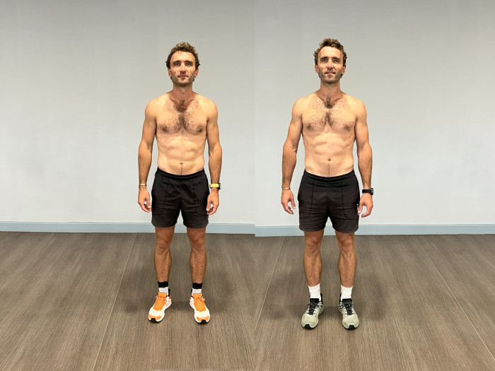 Identical twin study participants comparing fasting and non-fasting diet effects