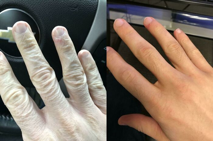 "Before And After Lotion"