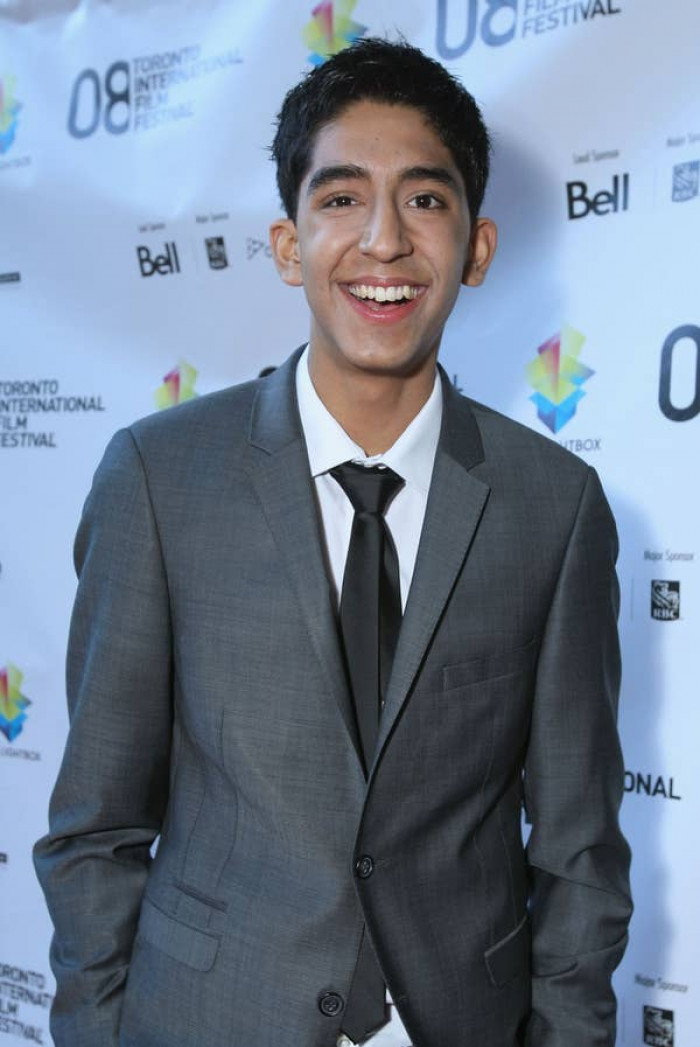 24. Dev Patel before: